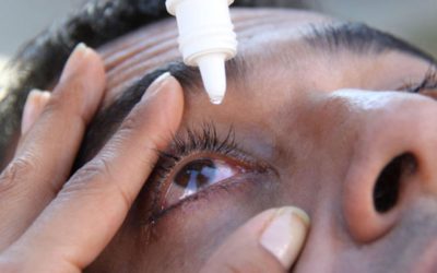 Conjuntivitis, qué es y cómo tratarla
