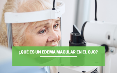 ¿Qué es un edema macular en el ojo?