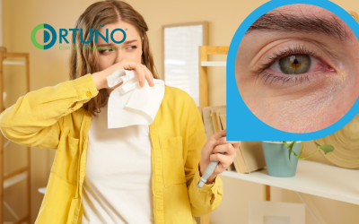 ¿Cómo saber si tengo alergia ocular?: consulta clínica